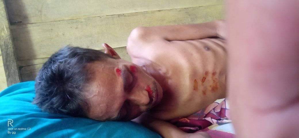 Warga Asal Pandeglang Sakit Parah Di Aceh Ingin Kembali Pulang Ke Kampung Halaman